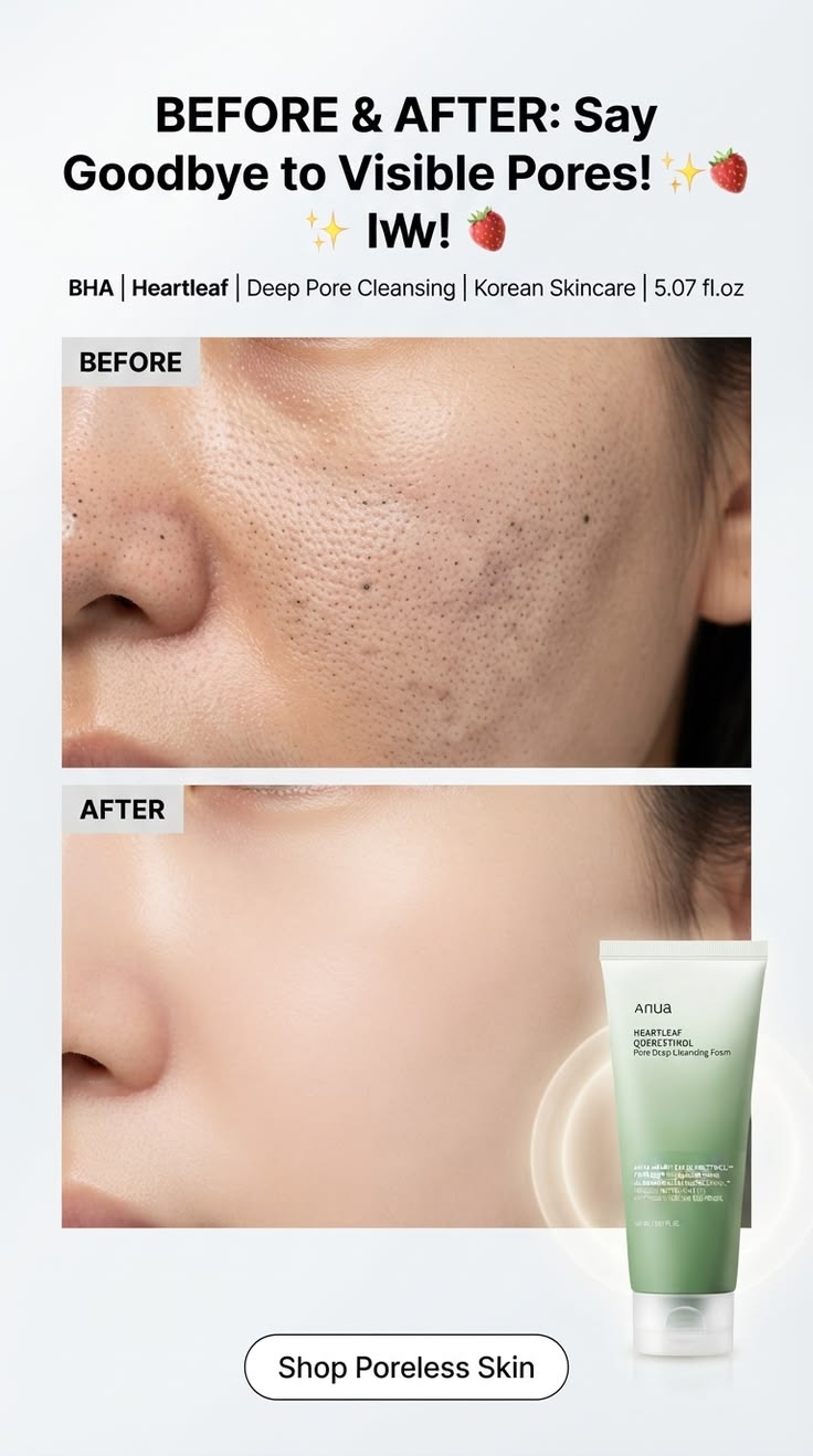ANUA PORE MINIMIZING DEAL