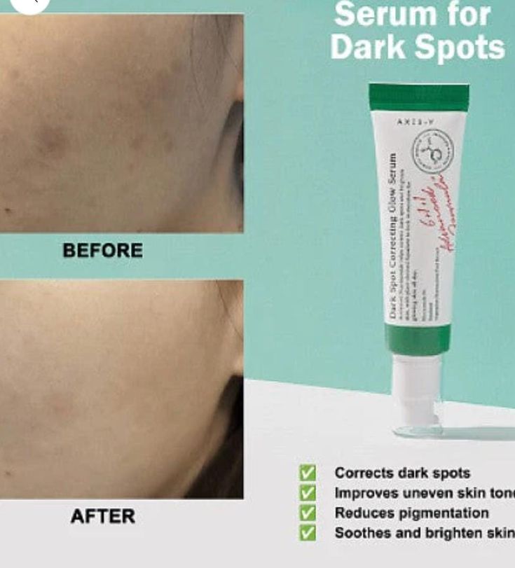 Dark Spot Correcting Glow Serum